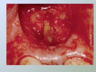 Paraendodôntica uepg