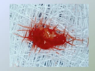 Paraendodôntica uepg