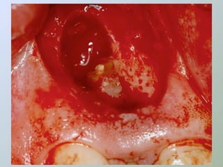 Paraendodôntica uepg