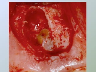 Paraendodôntica uepg