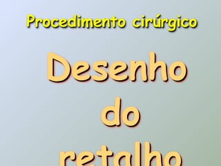 Procedimento cirúrgico


  Desenho
     do
 
