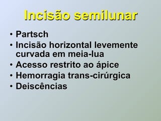 Incisão semilunar
• Partsch
• Incisão horizontal levemente
  curvada em meia-lua
• Acesso restrito ao ápice
• Hemorragia trans-cirúrgica
• Deiscências
 