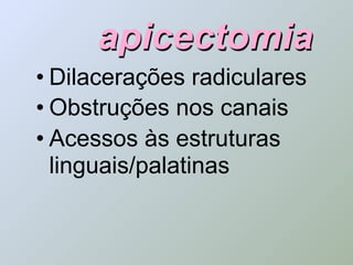 apicectomia
• Dilacerações radiculares
• Obstruções nos canais
• Acessos às estruturas
  linguais/palatinas
 