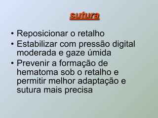 sutura
• Reposicionar o retalho
• Estabilizar com pressão digital
  moderada e gaze úmida
• Prevenir a formação de
  hematoma sob o retalho e
  permitir melhor adaptação e
  sutura mais precisa
 