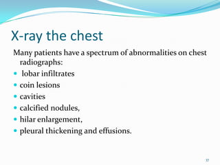 X-ray the chest
Many patients have a spectrum of abnormalities on chest
  radiographs:
 lobar infiltrates
 coin lesions
 cavities
 calcified nodules,
 hilar enlargement,
 pleural thickening and effusions.


                                                      37
 