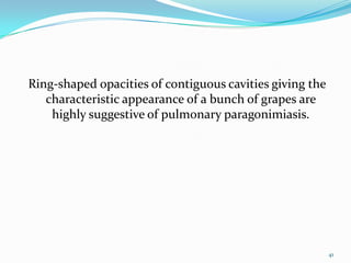 Ring-shaped opacities of contiguous cavities giving the
   characteristic appearance of a bunch of grapes are
    highly suggestive of pulmonary paragonimiasis.




                                                          41
 