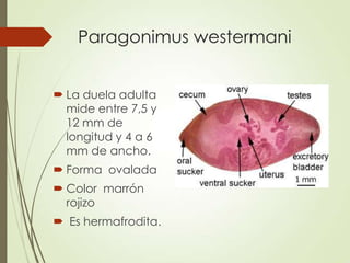 Paragonimus westermani
 La duela adulta
mide entre 7,5 y
12 mm de
longitud y 4 a 6
mm de ancho.
 Forma ovalada
 Color marrón
rojizo
 Es hermafrodita.
 