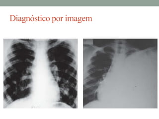 Diagnóstico por imagem

 