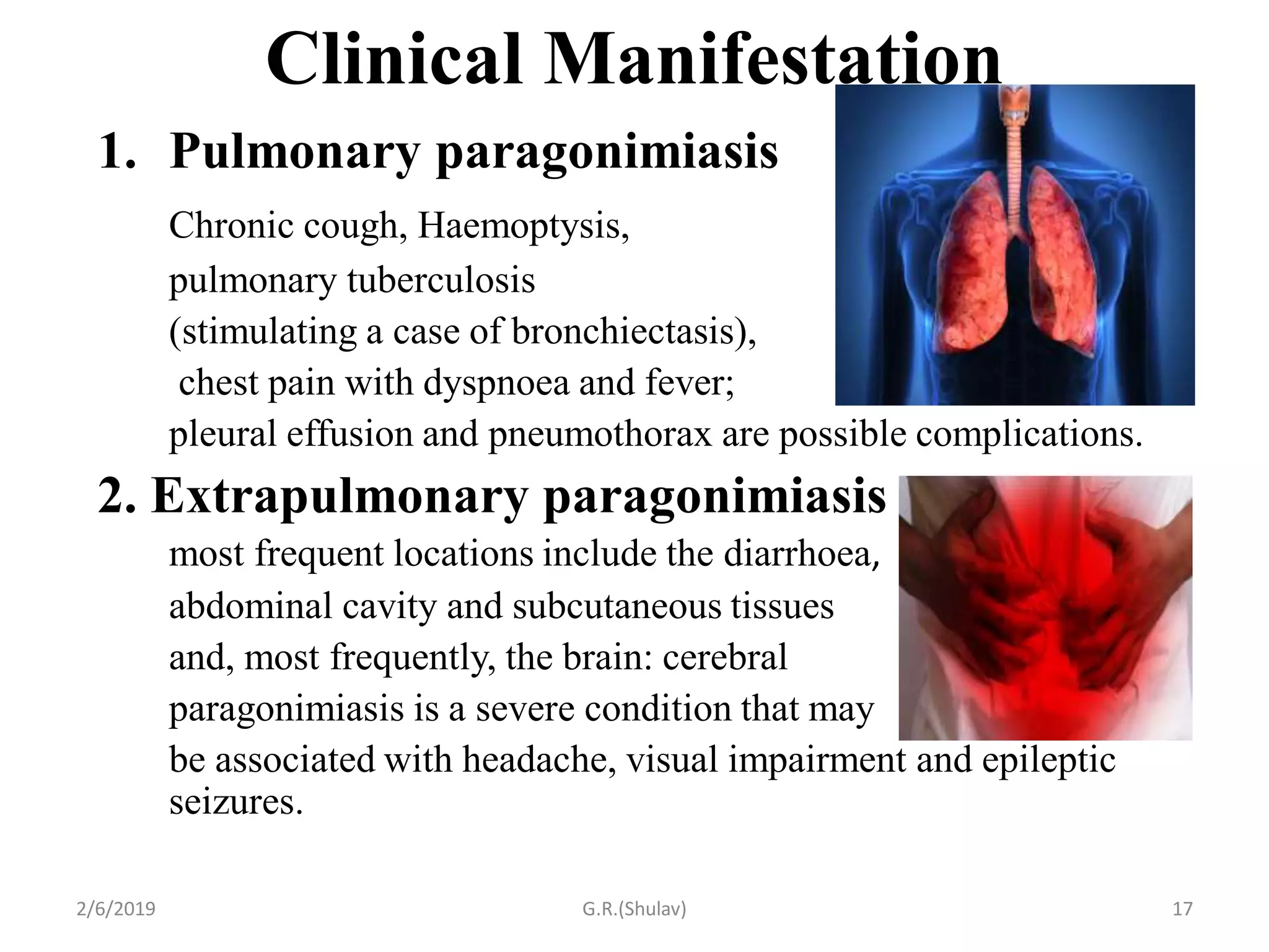 paragonimus-westermani-pdf