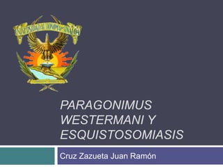 PARAGONIMUS
WESTERMANI Y
ESQUISTOSOMIASIS
Cruz Zazueta Juan Ramón
 