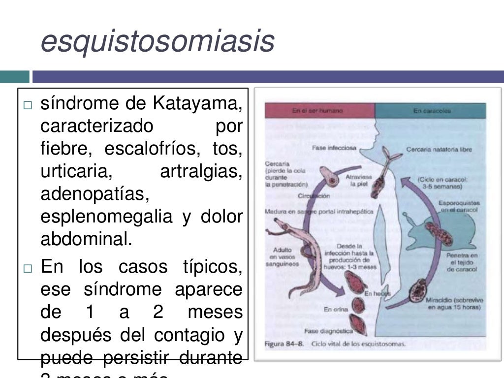 Paragonimus westermani y esquistosomiasis
