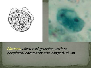 Isospora belliDisease:Isosporiasis; intestinal coccidiosis