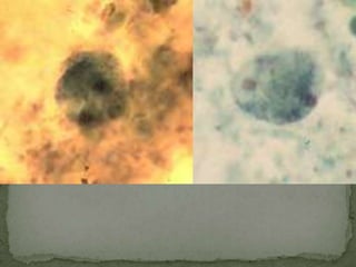 Transmission: hand to mouth or through		 contaminated food or water