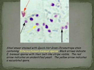 Microscopic wet mounts by bright-field, differential interference contrast (DIC), and epifluorescencemodified acid-fast stain.Laboratory Diagnosis: