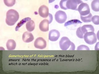 the trophozoite is the only stage in stoolsTrophozoites have characteristically one or two nuclei Life Cycle: