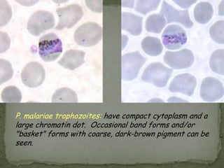 Nucleus: cluster of granules, with no peripheral chromatin; size range 5-15 µm.