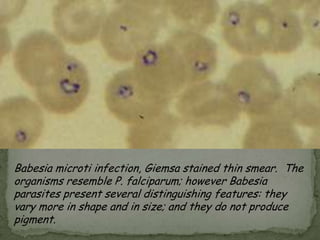 Lab Dx: Modified trichrome stain ; PCR