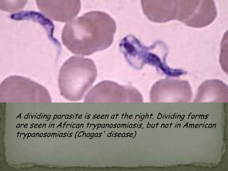 PLASMODIUMDisease: MalariaP. vivax: Benign tertian malariaP. malariae: Quartan malariaP. falciparum: Malignant tertian malariaP. ovale: Ovale tertian malariaLab Dx: Giemsa stained thick and thin blood smears; IFA; PCR
