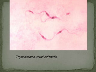 P. falciparum rings have delicate cytoplasm and 1 or 2 small chromatin dots.  Red blood cells (RBCs) that are infected are not enlarged; multiple infection of RBCs more common in P. falciparum than in other species.  Occasional appliqué forms (rings appearing on the periphery of the RBC) can be present.