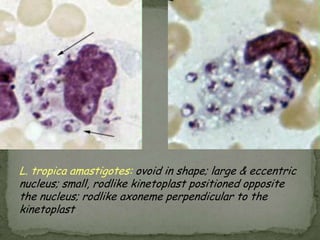 A dividing parasite is seen at the right. Dividing forms are seen in African trypanosomiasis, but not in American trypanosomiasis (Chagas' disease)