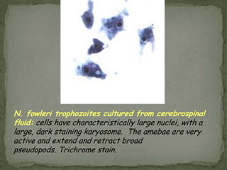Trypomastigote: shape is short & stubby to long & slender; in Giemsa stained blood films – C or U shaped; kinetoplast is large, oval & located posterior to the nucleus; anterior long free flagellum