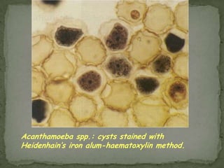 Trypanosoma cruzi: Leishmanial form 