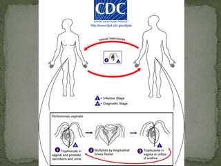 Ramana's sign: unilateral conjunctivitis and orbital edema  