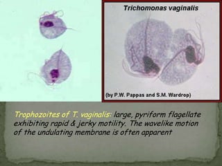 Chaga'sDiseaseasymptomatic- mostly