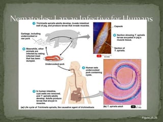 Toxoplasma gondii cyst in brain tissue stained with hematoxylin and eosin (100×).