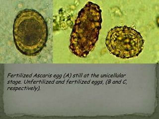 Acanthamoeba:Chronic Granulomatous Amebic Encephalitis and keratitis