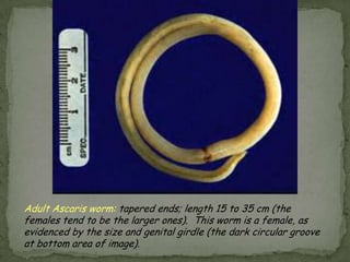 Lab Dx: Direct microscopic exam (Wheatley’s trichromestain)PROTOZOA FROM OTHER BODY SITES