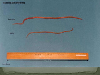 FREE LIVING AMEBAEPortal of Entry: