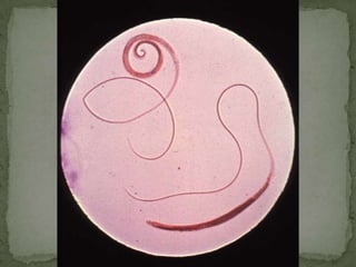 184MANAGEMENTMetronidazole (Flagyl)include partnersCX: PROM