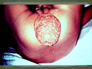 The HelminthsTable 12.1