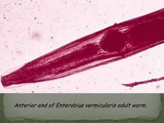 Humans as Definitive HostFigure 12.26