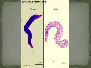 CestodesFigure 12.27