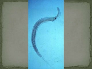Strongyloides stercoralisINTESTINAL CESTODES