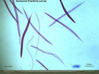 Paragonimus westermani