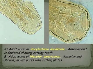 Schistosoma haematobium