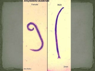 Schistosoma japonicumTISSUE NEMATODES & CESTODES