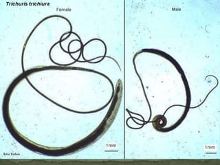 Trichinella spiralis