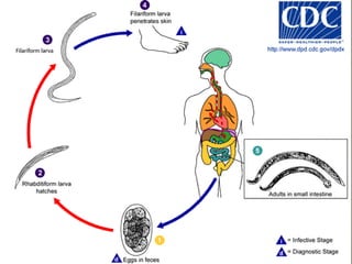 Spirometra speciesCausal Agents:The nematode (roundworm) Capillariaphilippinensis causes human intestinal capillariasisC. hepatica-- humans hepatic capillariasisC. aerophila-- humans pulmonary capillariasis.