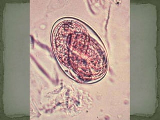 Diagnostic findingsMicroscopyTreatment:The drug of choice is mebendazole*, and albendazole* is an alternative. 