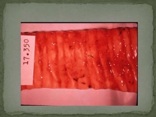 Infective stage: ova containing second stage larva