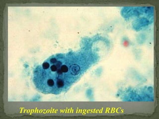 Fresh stool: wet mounts and permanently stained preparations (e.g., trichrome)Concentrates from fresh stool: wet mounts, with or without iodine stain, and permanently stained preparations E. histolyticatrophozoites can also be identified in aspirates or biopsy samples obtained during colonoscopy or surgery.Laboratory Diagnosis: