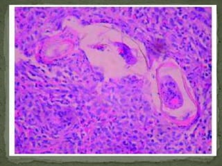 Life Cycle:The unembryonated eggs are passed with the stool .  In the soil, the eggs develop into a 2-cell stage embryonate eggs After ingestion (soil-contaminated hands or food), the eggs hatch in the small intestine-larvae - adults in the cecum and ascending colon.  Female worms in the cecum shed between 3,000 and 20,000 eggs per day. 