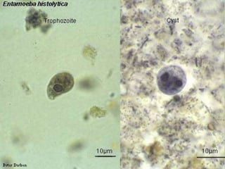 MicroscopyImmunodiagnosisMolecular methods for discriminating between E. histolytica and E. disparMorphologic comparison with other intestinal parasitesBench aid for E. histolyticaDiagnostic findings: