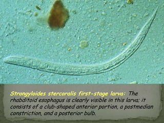 Diagnostic findingsmicroscopyExamination of the rectal mucosa by proctoscopy (or directly in case of prolapses) can occasionally demonstrate adult worms.Treatment:Mebendazole is the drug of choice, with albendazole as an alternative. 