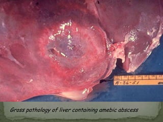 Trophozoite with ingested RBCs