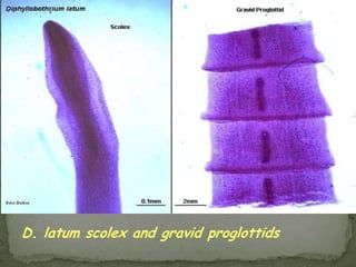 Case 1011-year-old femaleDoing poorly in schoolNot sleeping wellAnorecticComplains of itching in rectal region throughout the dayA Scotch-tape test reveals…